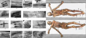 the tattoos of 5 300 year old swiss alps iceman mummy otzi Tattoo Platform